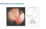Методы лечения железисто-фиброзного полипа эндометрия и реабилитация после его удаления